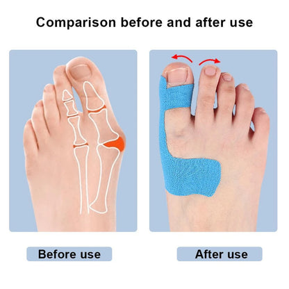 Pre-Cut Kinesiology Toe Tape | Bunion Support & Toe Alignment Tape (10 PCS)
